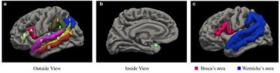 Sex differences of language abilities of preschool children with autism spectrum disorder and their anatomical correlation with Broca and Wernicke areas